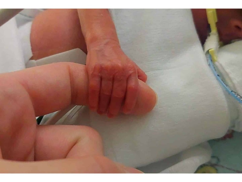 A premature baby holds on to an adult's finger.