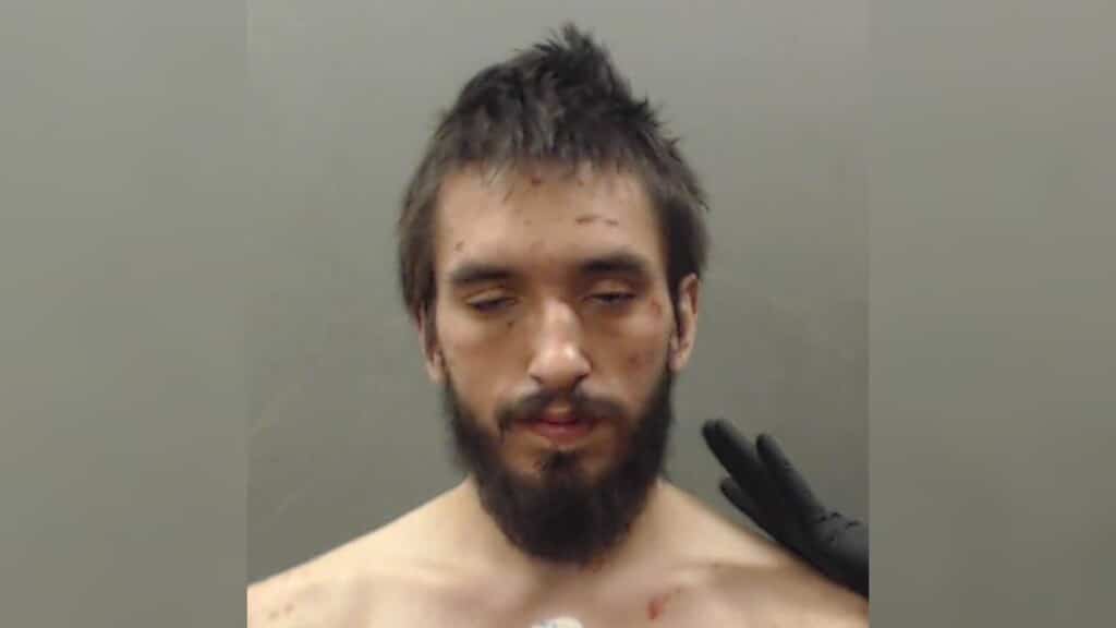 A photo of a man with brown hair and brown eyes with cuts on his face and his eyes half closed.