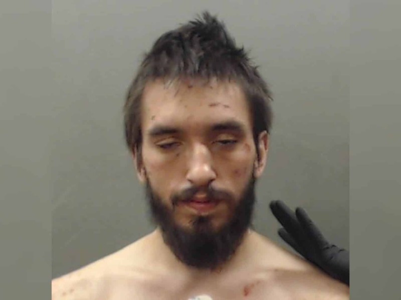 A photo of a man with brown hair and brown eyes with cuts on his face and his eyes half closed.