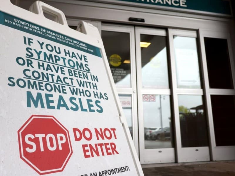 There has been an outbreak of measles in B.C. in 2025. (THE CANADIAN PRESS/Nicole Osborne)